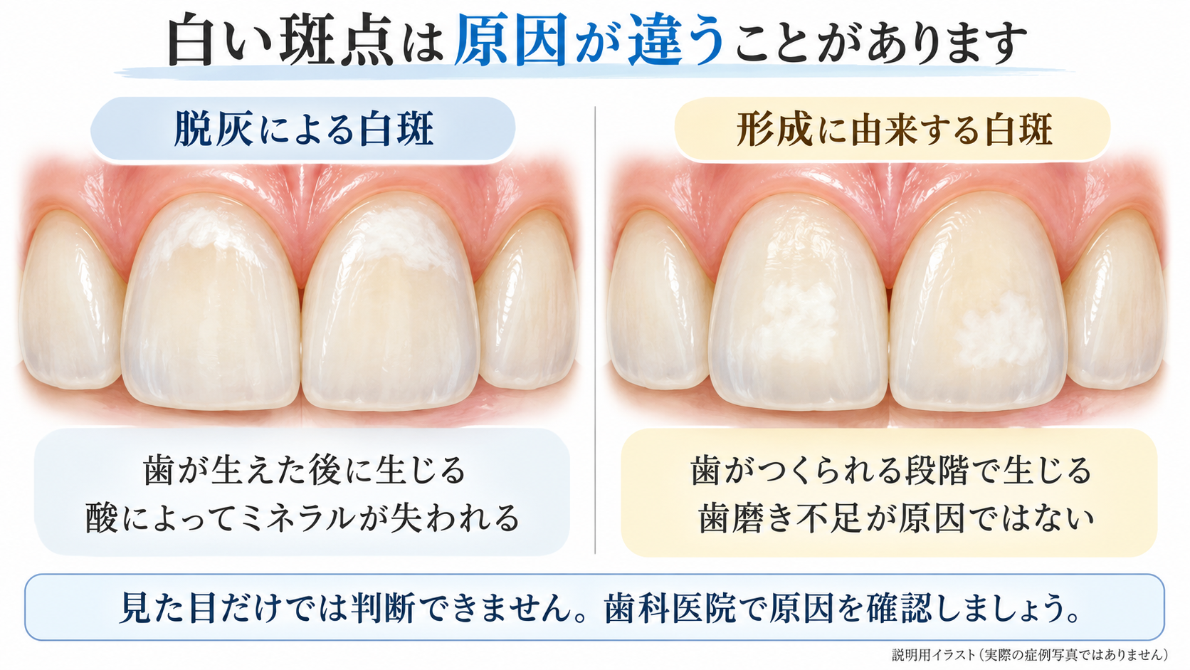 白斑の原因を比較した説明図